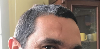 DR. RODRIGO PROTO SIQUEIRA FALA DAS VARIANTES DO CORONAVIRUS – Podcast