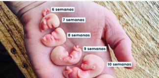 ARTIGO – NÃO É UM AMONTOADO DE CÉLULAS